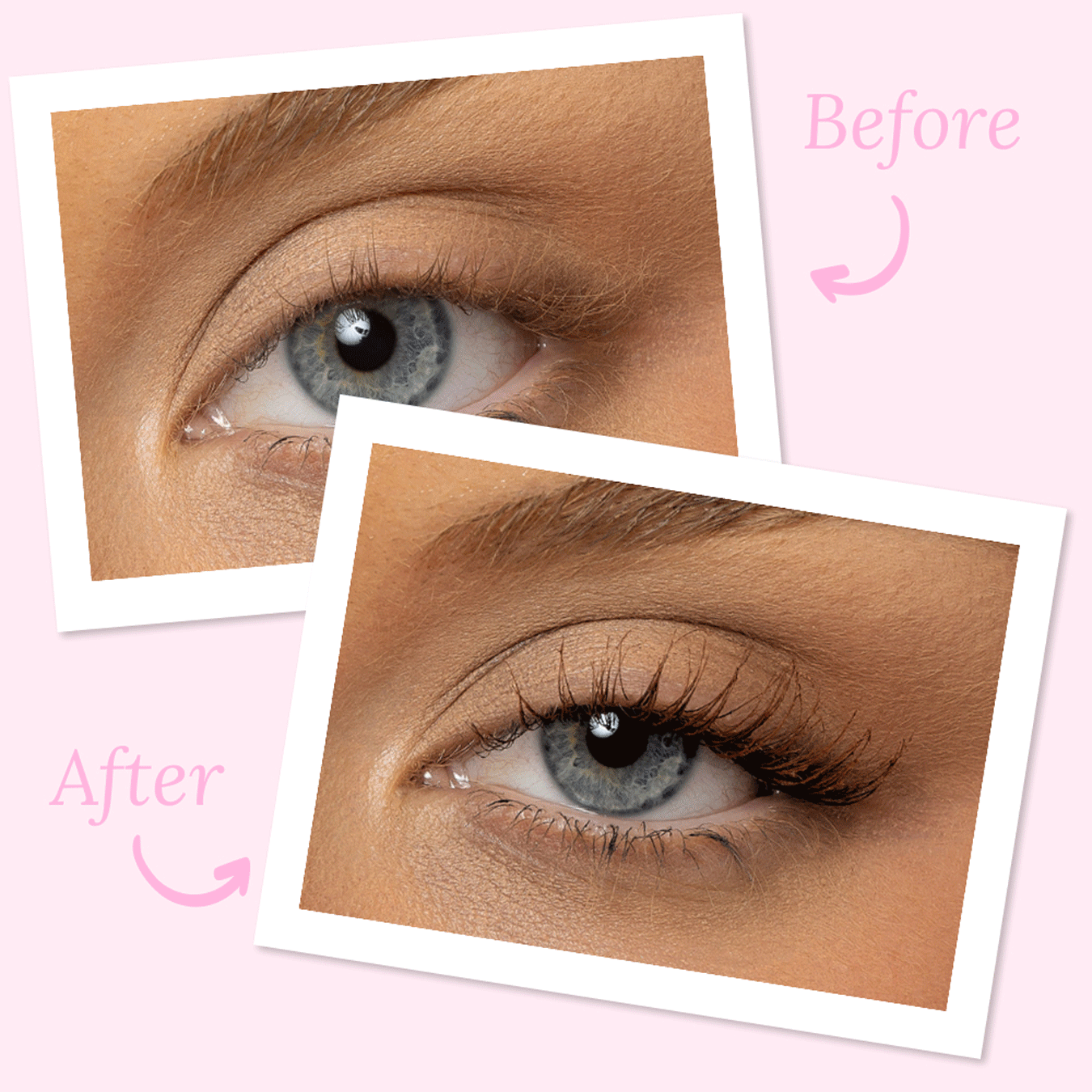 LT-Before-After.gif